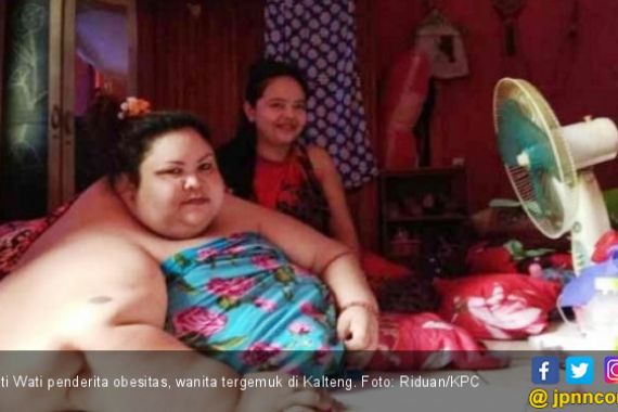 Pengin Tahu Berat Badan Penderita Obesitas Titi Wati Saat Ini? Duh… - JPNN.COM