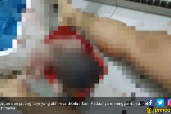 PRT di Medan Tewas Usai Gugurkan Kandungan - JPNN.COM