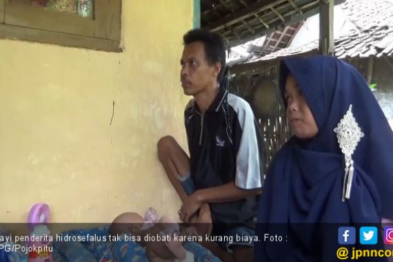 Tolong Bantu Biaya Pengobatan Bayi Hidrosefalus Ini.. - JPNN.COM