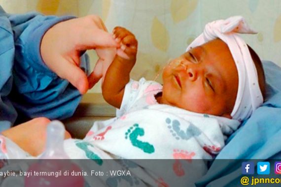Bayi Prematur Terkecil di Dunia, Bobot Hanya Seberat Apel - JPNN.COM