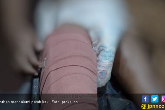 Pengasuh Kejam, Siksa Bocah Tiga Tahun Pakai Kayu hingga Patah Tulang - JPNN.COM