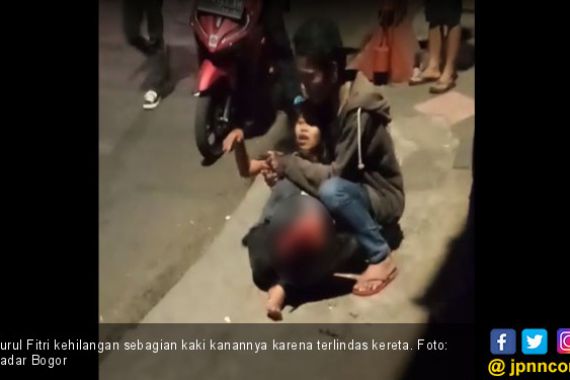 Kaki Kanan Wanita Ini Putus Usai Terlindas Kereta Jurusan Sukabumi–Bogor - JPNN.COM