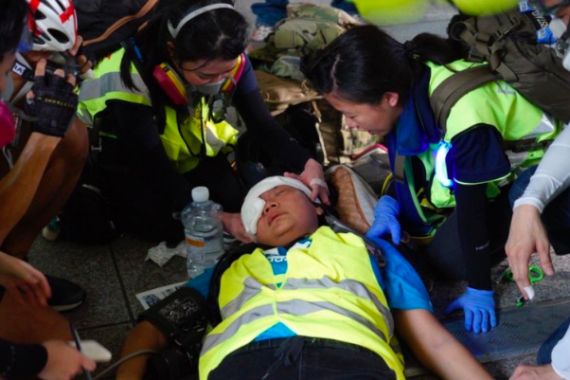 Wartawati asal Indonesia Kena Peluru Saat Liput Demo di Hong Kong - JPNN.COM