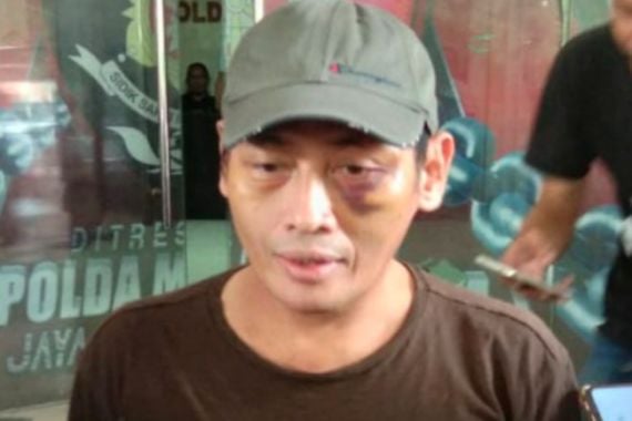 Detik-detik Ninoy Karundeng Diculik, Dihajar, Diinterogasi dengan Kata-kata Mengerikan - JPNN.COM