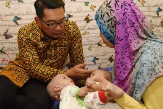 Ridwan Kamil Jenguk Bayi Kembar Siam di Bekasi - JPNN.COM