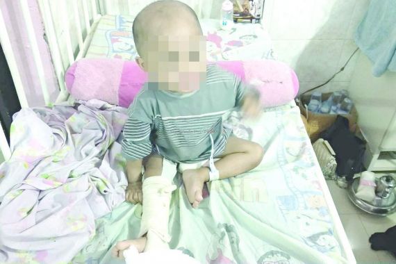 Seorang Bayi Disiksa Ibunya karena Wajahnya Mirip dengan Mantan Suami - JPNN.COM