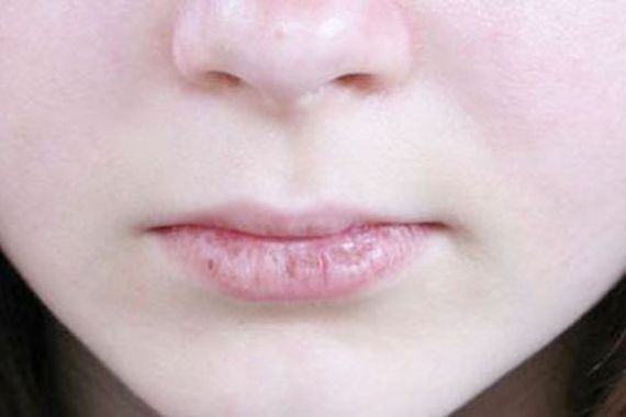 Ini Cara Mudah Agar Bibir Tak Kering saat Berpuasa - JPNN.COM