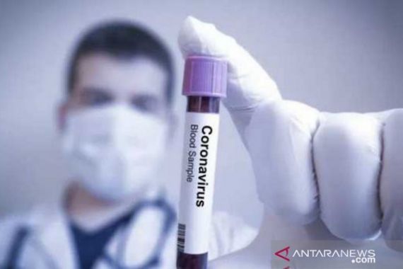 Dokter Muda Terinfeksi Corona di RSPAD Gatot Subroto - JPNN.COM
