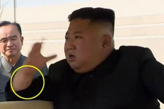 Lihat, Ada Keanehan di Tangan Kanan Kim Jong-un - JPNN.COM