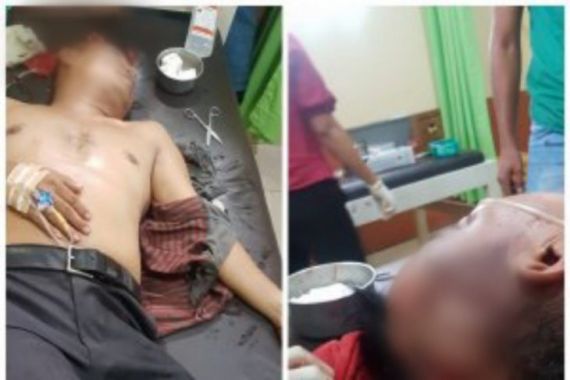 Info Terkini dari Polisi Soal Kades Joni yang Diserang Pakai Kapak saat Cek Pos COVID-19 - JPNN.COM