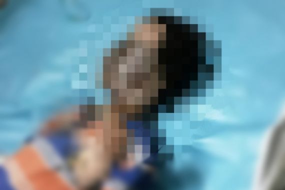 Bocah 8 Tahun Terbakar Saat Bermain Tiner - JPNN.COM