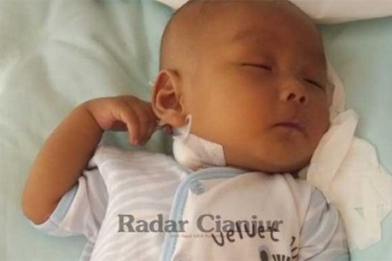 Baru 3 Bulan Melihat Dunia, Bayi di Cianjur Ini Mengidap Penyakit Langka - JPNN.COM