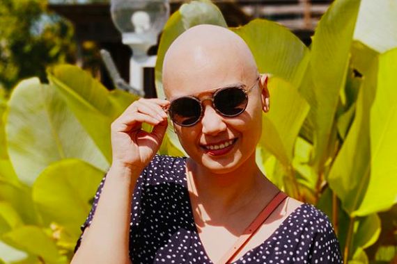 Kabarkan Kondisi Terbaru Pasca-kemoterapi, Feby Febiola: Semua di bawah Rata-rata - JPNN.COM
