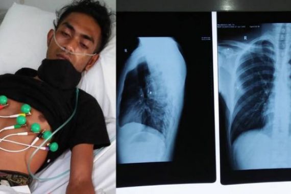 Dor, Mahasiswa NTT di Tangsel jadi Korban Penembakan, Peluru Pecah di Paru-paru - JPNN.COM