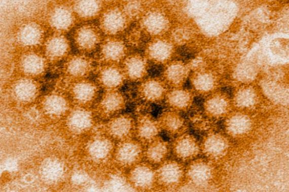 5 Fakta tentang Norovirus, Virus Lama yang Muncul Kembali - JPNN.COM