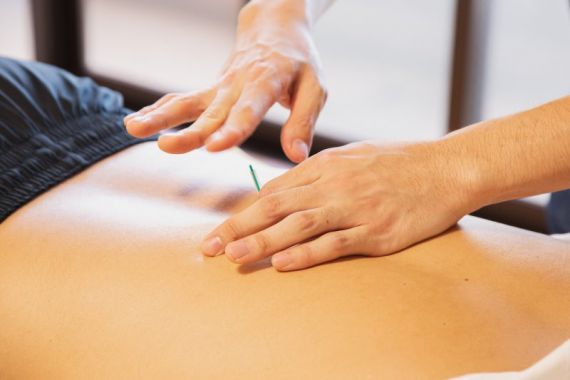 Benarkah Pengobatan Akupunktur Bisa Mengatasi Insomnia? - JPNN.COM