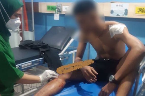 2 Pemuda Tiba-Tiba Diserang OTK Pakai Parang, Kondisi Mengenaskan Begini - JPNN.COM