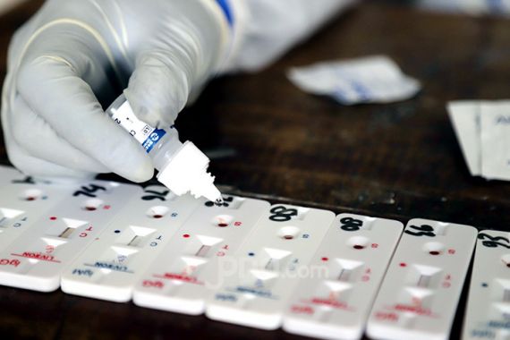 Buntut Alat Rapid Test Antigen Bekas, Dirut Kimia Farma Diagnostik Ikut Diperiksa Polisi - JPNN.COM