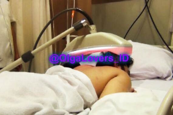 Sakit Keras, Fans Posting Foto Kepala Olga Difisioteraphy - JPNN.COM