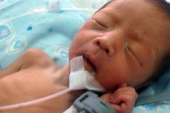 Bayi Bertahan Hidup setelah Dikubur Dua Jam - JPNN.COM