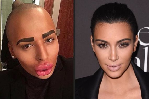 Terobsesi Kim Kardashian, 50 Kali Suntik Bibir - JPNN.COM
