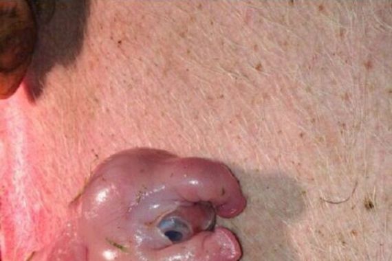 Upsss...Anak Babi Ini Berwajah Manusia dengan Penis di Kepala - JPNN.COM