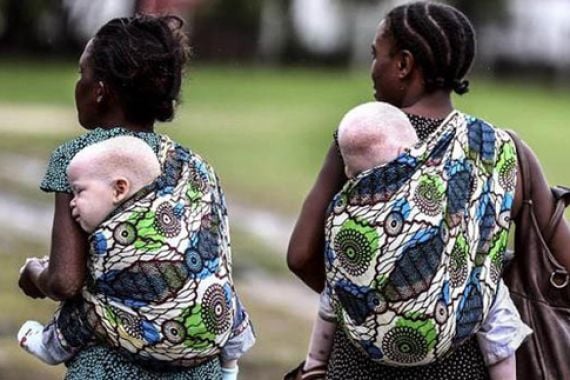 225 Dukun Ditangkap terkait Pembunuhan dan Perdagangan Organ Orang Albino - JPNN.COM