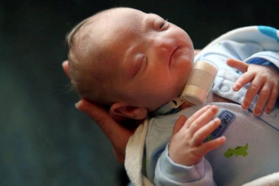 Keajaiban Tuhan, Bayi Lahir Tanpa Hidung dan Ibunya Berkata Dia Sempurna - JPNN.COM