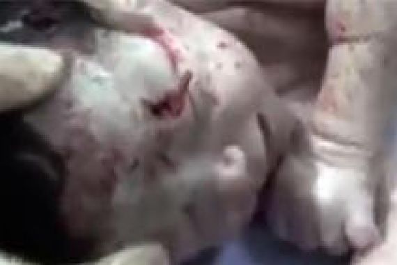 Video Dramatis Bayi Korban Pecahan Rudal Diselamatkan Dokter Suriah - JPNN.COM