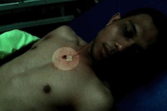 Dada Mahasiswa Ini Bolong Ditembak saat Pesan Makanan Di Warung Pecel Lele, Ini Fotonya - JPNN.COM