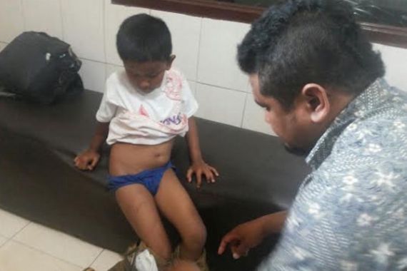 Komnas PA Kirim Timsus untuk Evakuasi Bocah yang Dipukuli Ayahnya - JPNN.COM