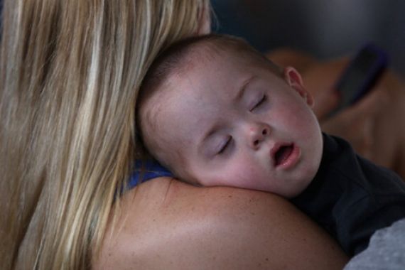 Batuk Rejan pada Bayi Bisa Meningkatkan Resiko Epilepsi - JPNN.COM