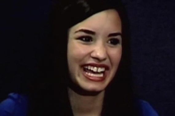 Ini Wujud Demi Lovato Sebelum Giginya Dipermak - JPNN.COM