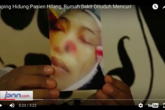 Dituduh Curi Hidung Jenazah Pasien, Ini Penjelasan RSUD - JPNN.COM