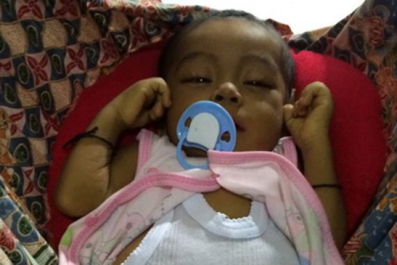 Yuk Dibantu! Bayi Ini Sakit Parah dan Harus Operasi, Biayanya Rp 1 Miliar - JPNN.COM