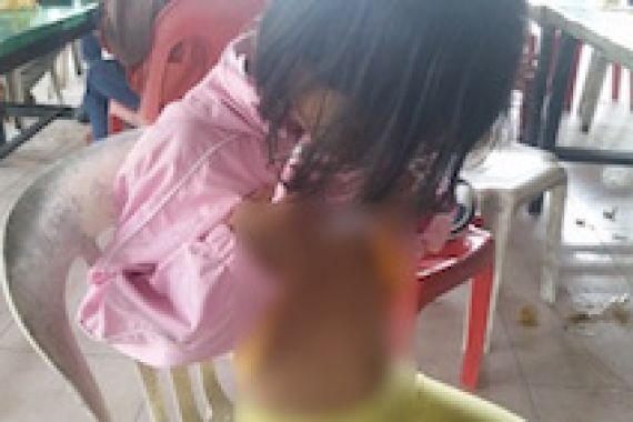 Bocah yang Disiksa Ibu Angkatnya Itu Diduga Korban Trafiking - JPNN.COM