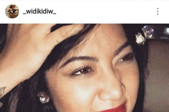 Netizen: Widy Vierra Kok Enggak Pesek Lagi, Operasi Hidung? - JPNN.COM