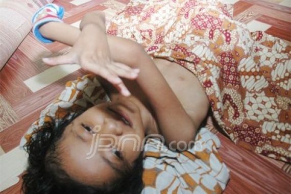 Lumpuh dan Mengecil, Titin Menanti Uluran Dermawan - JPNN.COM