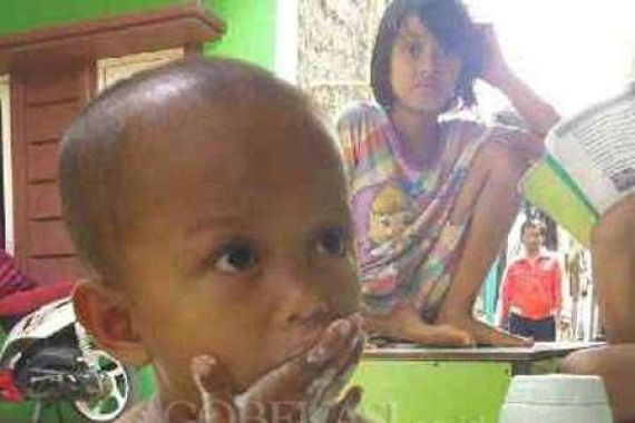 Bocah 3 Tahun Doyan Makan Bedak dan Batu Kerikil - JPNN.COM