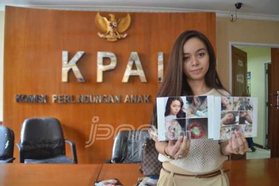 Polisi Melempem, Artis Korban Penyiraman Air Keras Itu Berharap KPAI - JPNN.COM