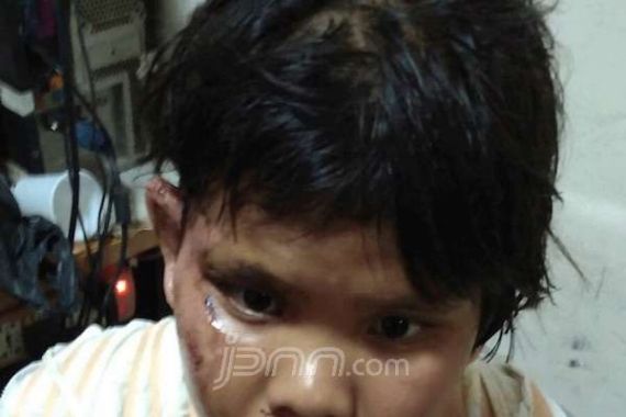 Ayah Anak yang Dibakar Ibunya Itu Bilangâ€¦ - JPNN.COM