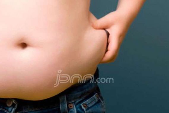 Hati-hati, Obesitas bisa Mengurangi Masa Hidup - JPNN.COM