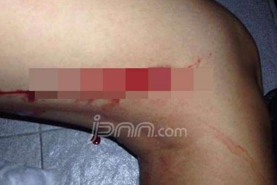 Waspada, Ada Teror Sayat Paha Wanita Muda - JPNN.COM