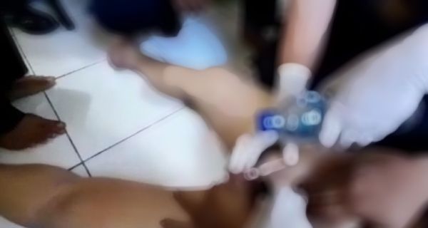 Kata Pemadam Seusai Evakuasi Ring yang Menjepit Anu Pria di Tangerang, Agak Geli Gimana Gitu - JPNN.com